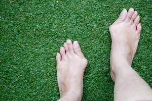 Hallux valgus, woman legs barefoot with bunions stand on green grass backgroud