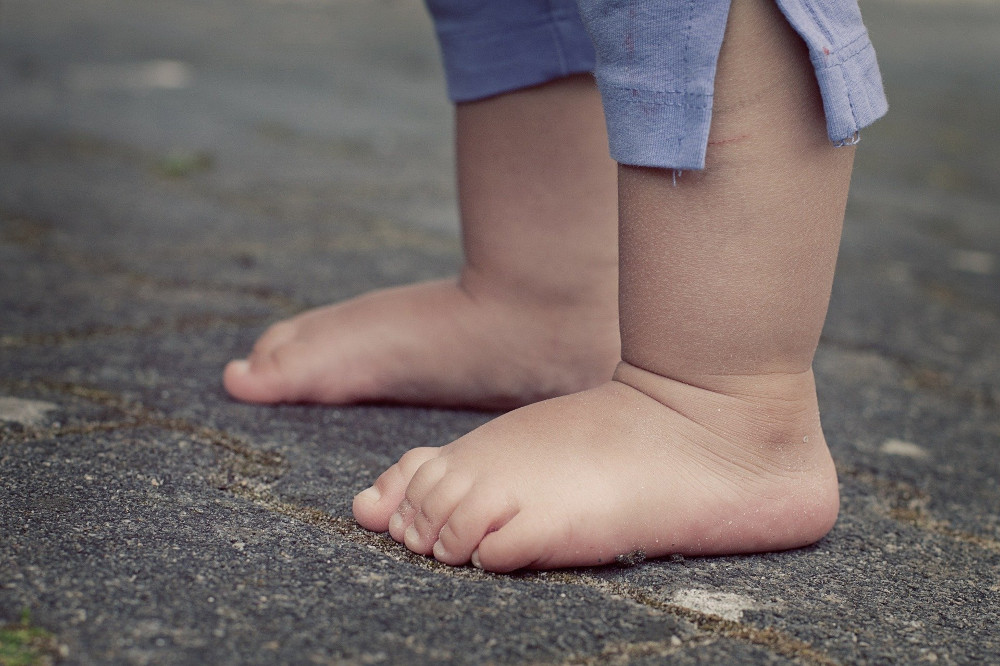 Children's Feet and Overuse Injuries